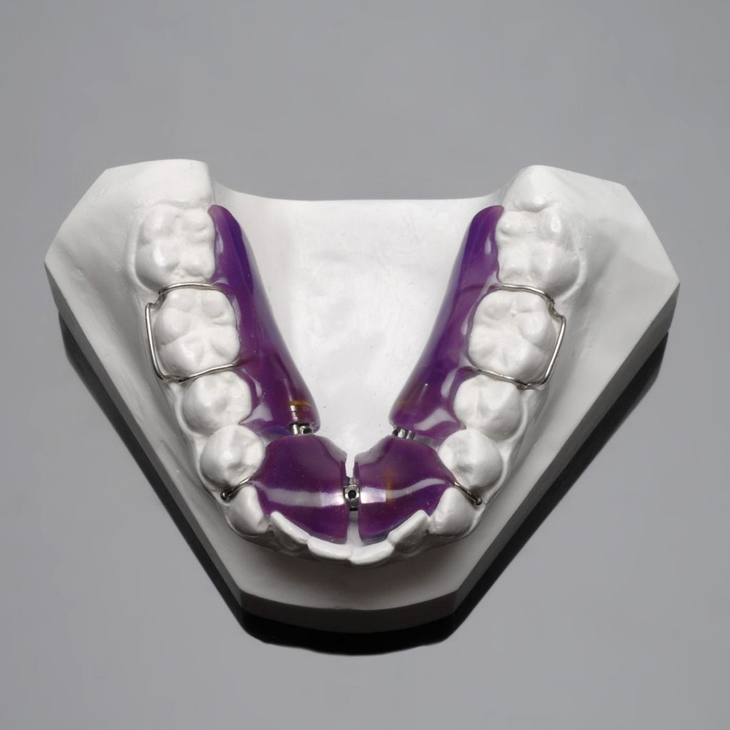Fixed Retainer AmericanOrtho