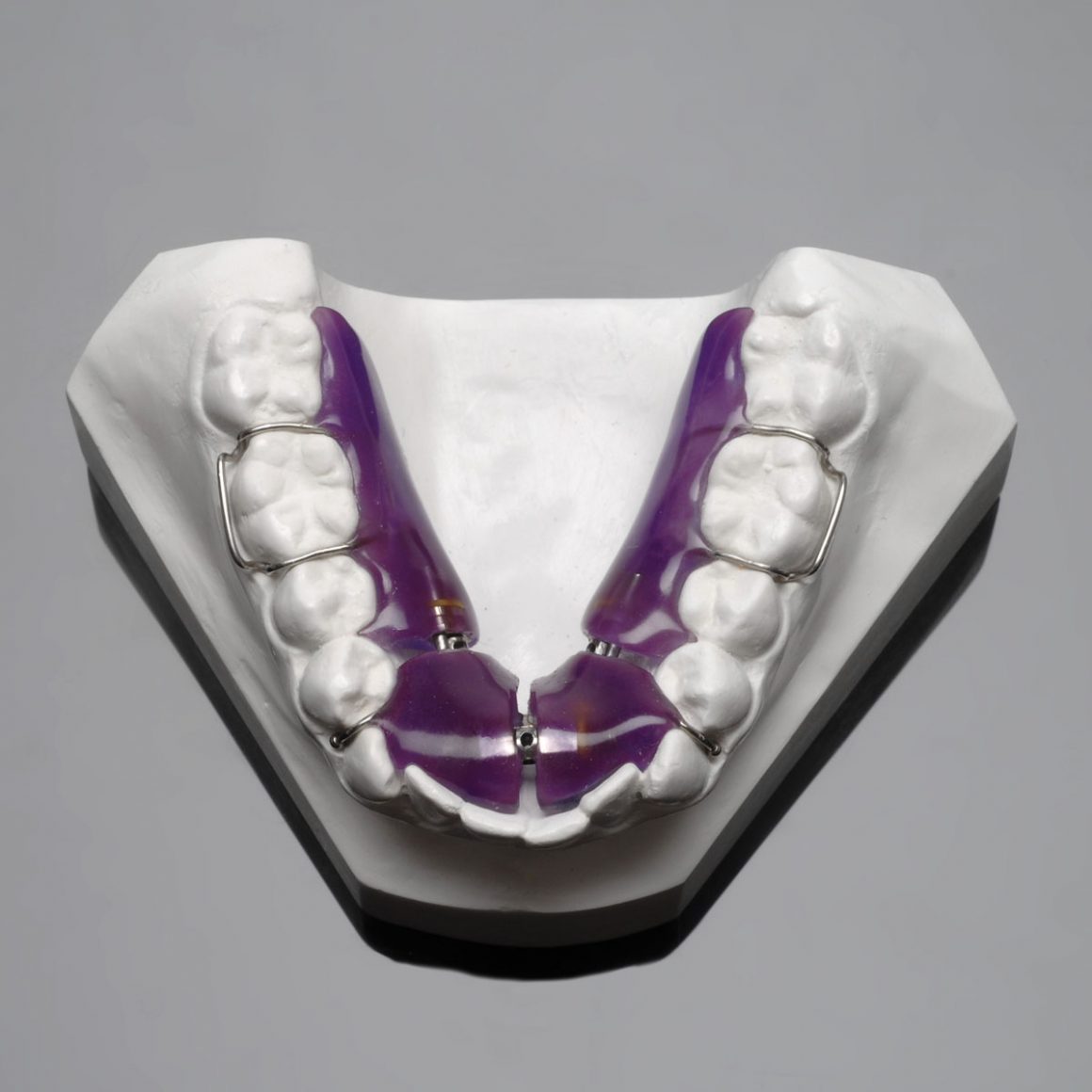3 Way Sagittal Appliance AmericanOrtho